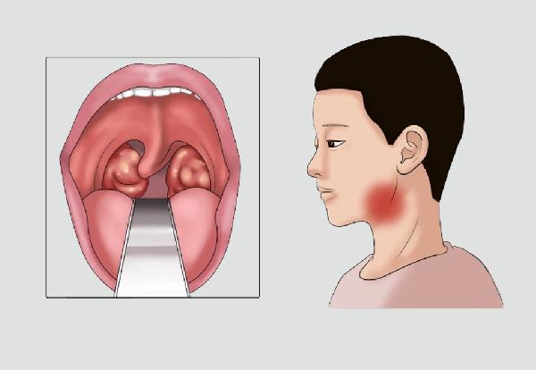 油腻食物吃太多了怎么办？这6种食物有利于消除油腻！